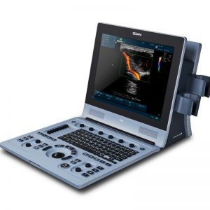 U60 Vet Diagnostic Ultrasound