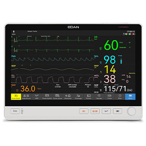 UX15 Patient Monitor