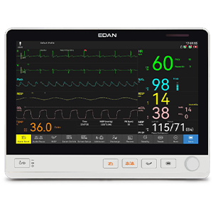 UX12 Patient Monitor