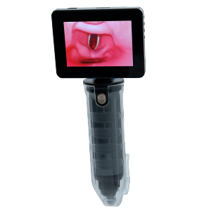 MDPro EZvision Laryngoscope