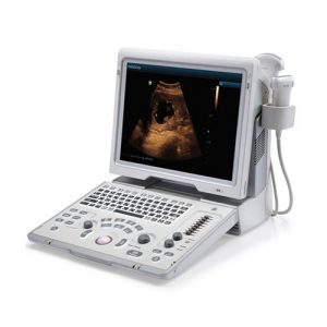 Mindray Z6 Diagnostic Imaging Scanner